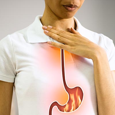 GERD/Acid Reflux