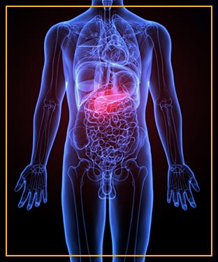 Pseudocyst Drainage in Advanced Gastroenterology of Central Florida