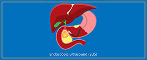 Endoscopic Ultrasound in Kissimmee, FL, and Orlando, FL